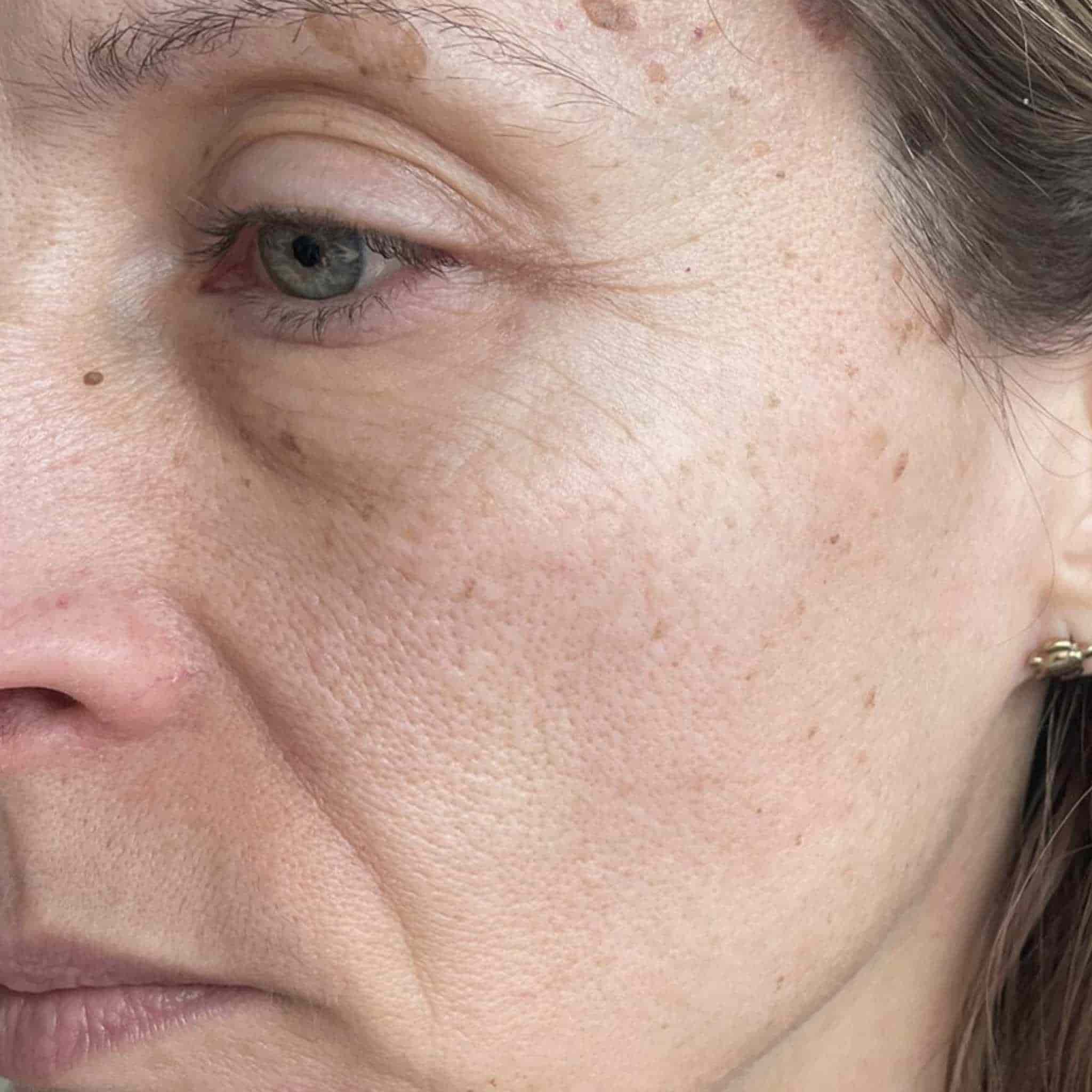 Contour de l oeil avant application huile Absolue